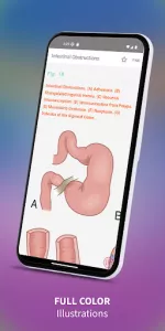 Medical Surgical RN Companion app screenshot 11