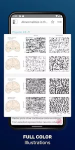 Principles of Neural Science app screenshot 11