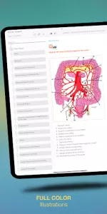 Surgical Recall app screenshot 19