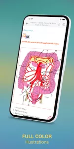Surgical Recall app screenshot 3