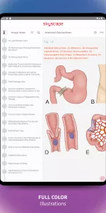 Medical Surgical RN Companion app screenshot 19