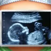 Step-by-Step Tutorial: Master Operate Now Hospital  for Better Games