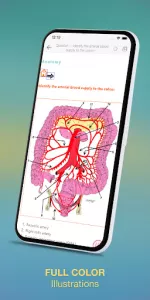 Surgical Recall app screenshot 11